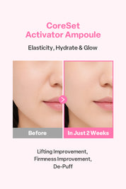 CCLIME CoreSet Activator Ampoule